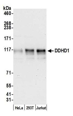 Detection of human DDHD1 by WB.