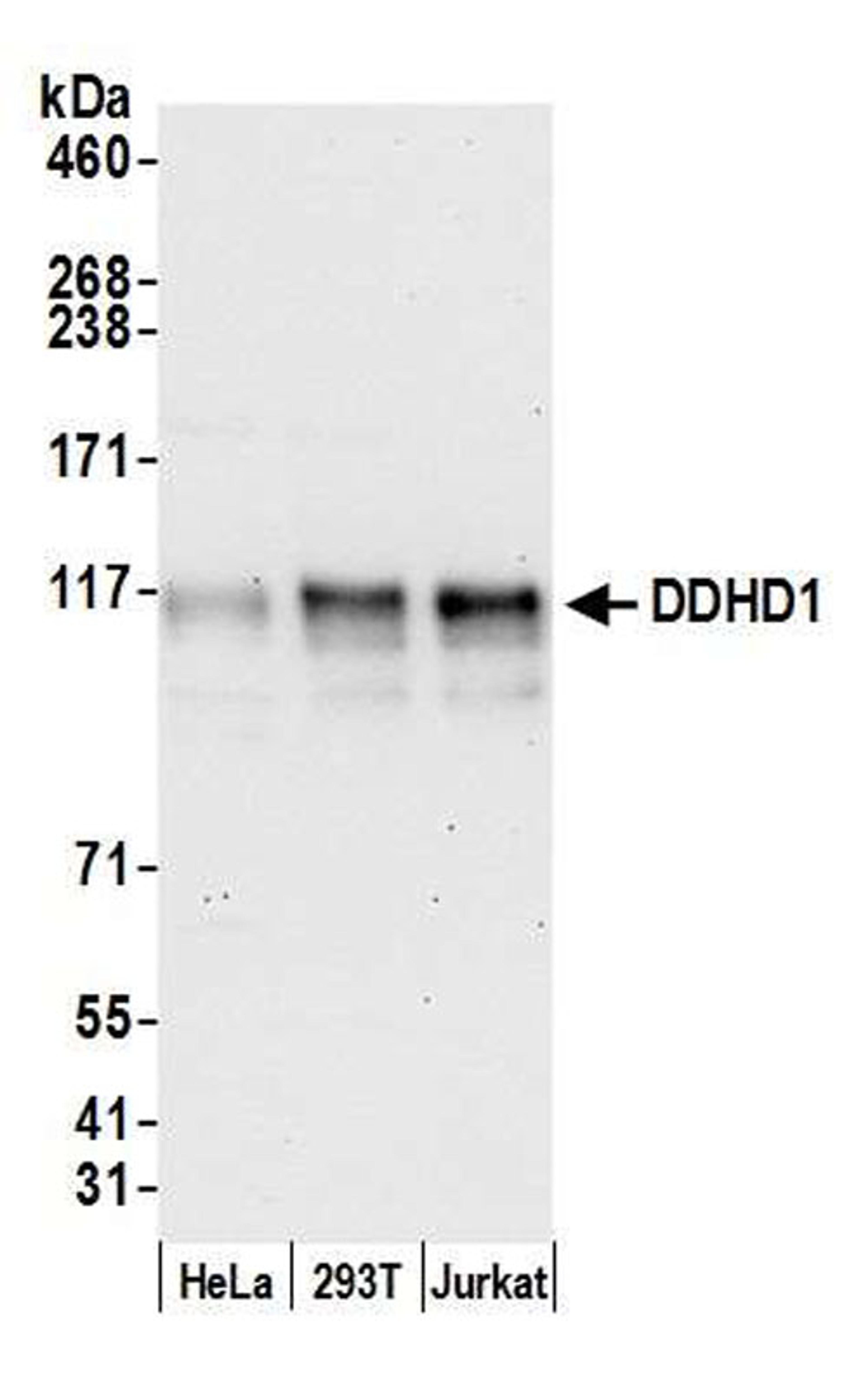 Detection of human DDHD1 by WB.