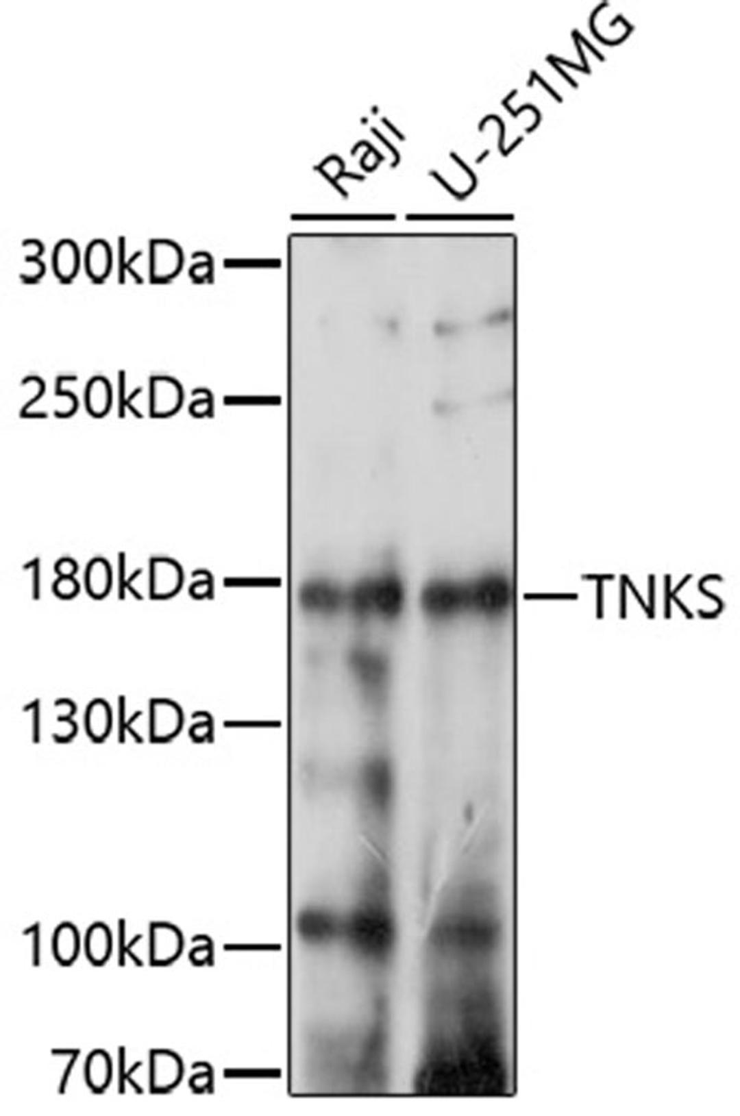 Western blot - TNKS antibody (A17027)