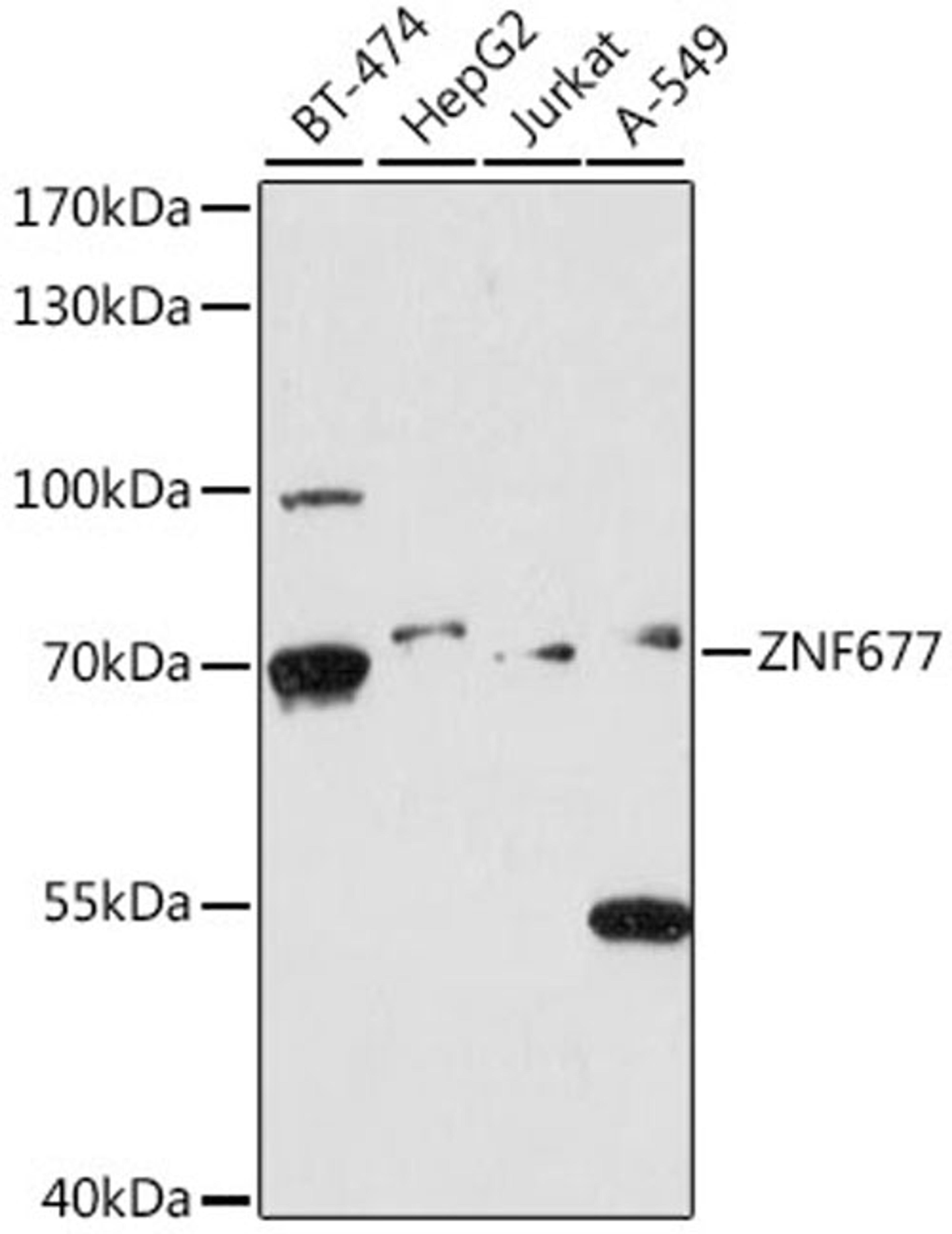 Western blot - ZNF677 antibody (A16183)