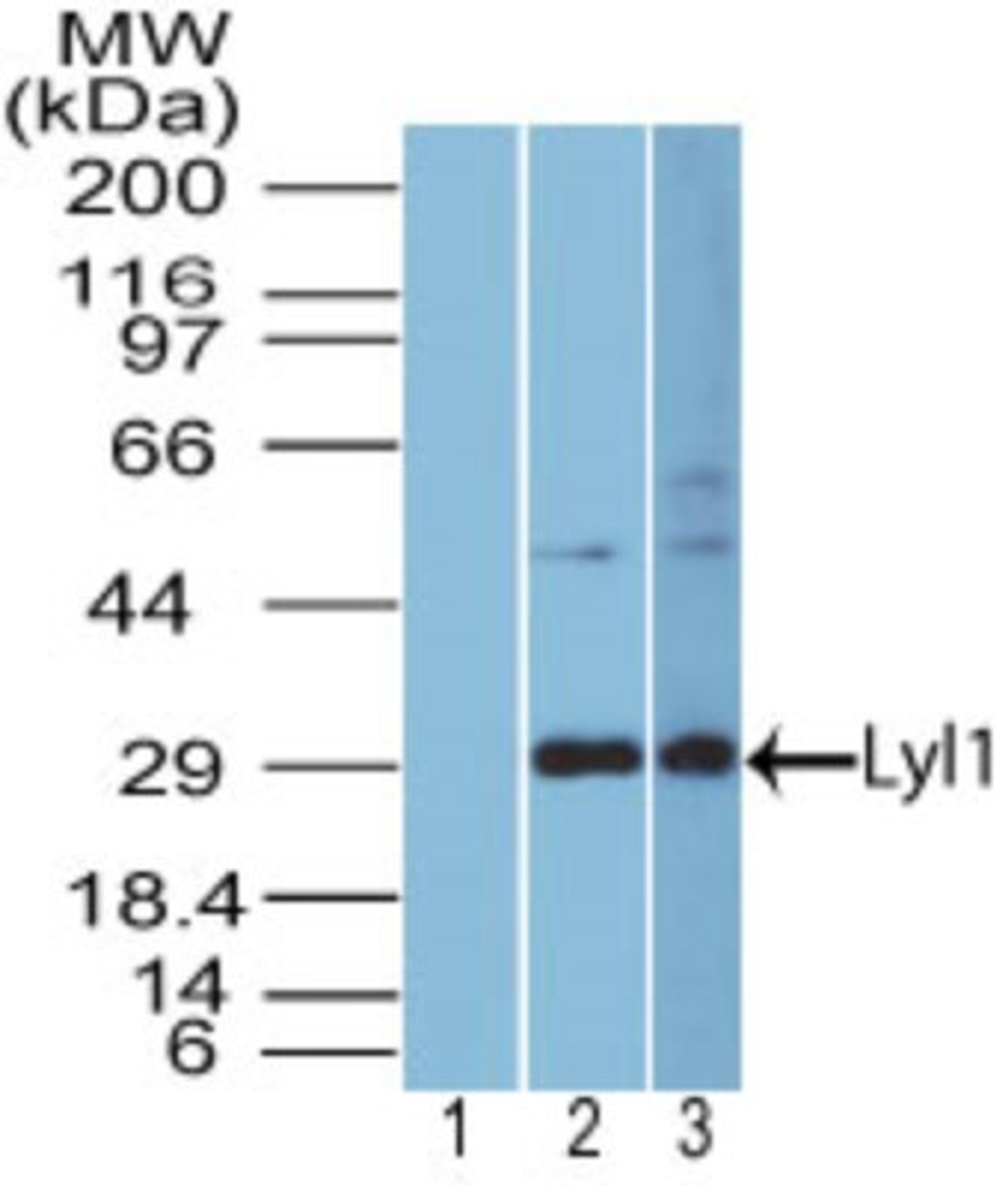 Western Blot: Lyl1 Antibody [NBP2-27188] - analysis of Lyl1. Lanes 1 and 2 show human HEPG2 cell lysate probed with pre-immune sera (1:5000) and Lyl polyclonal antibody (4 ug/ml), respectively, and lane 3 shows mouse NIH 3T3 cell lysate probed at 4 ug/ml.