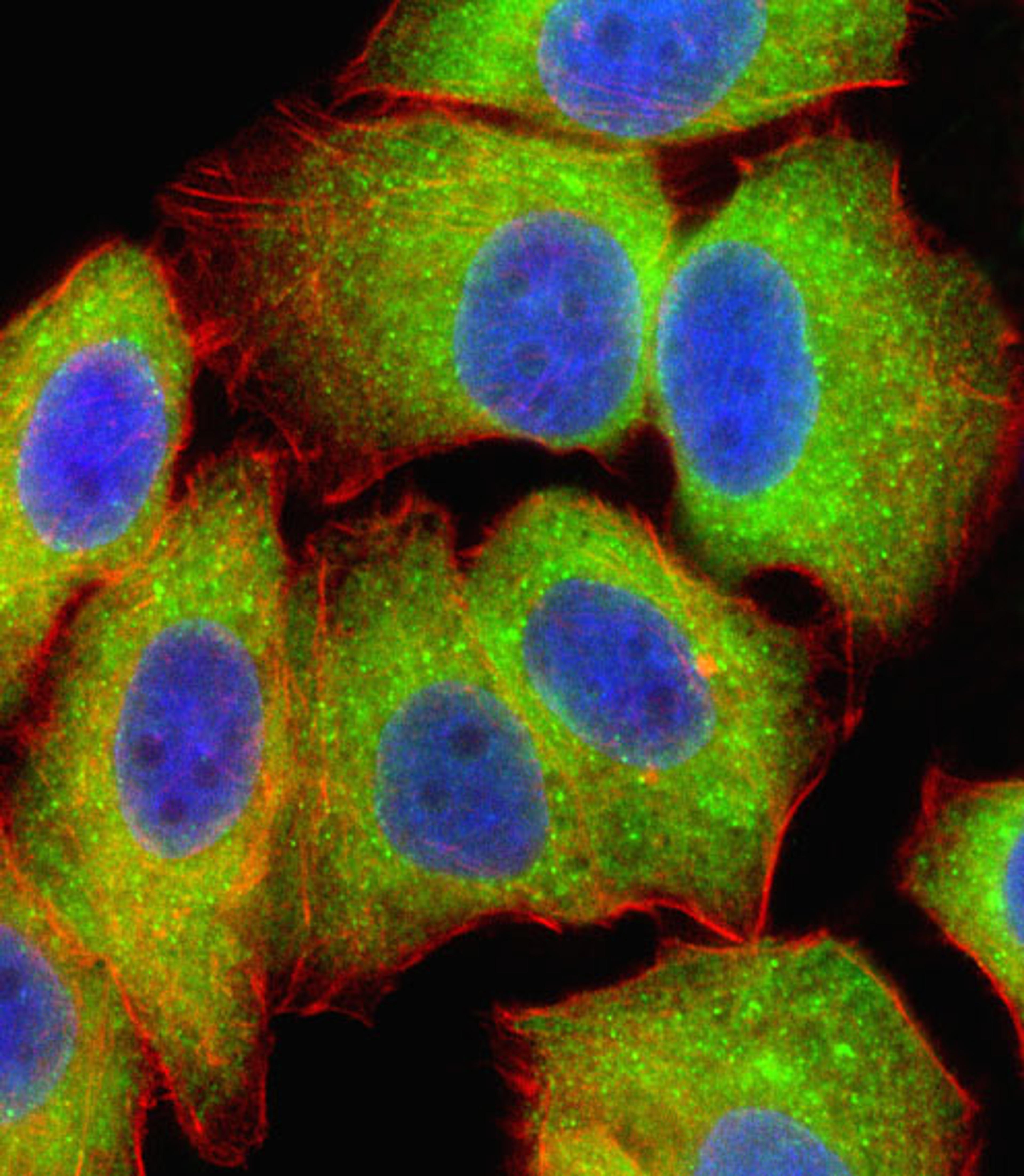 Fluorescent confocal image of U251 cell stained with RELA Antibody .U251 cells were fixed with 4% PFA (20 min), permeabilized with Triton X-100 (0.1%, 10 min), then incubated with RELA primary antibody (1:25). For secondary antibody, Alexa Fluor 488 conju