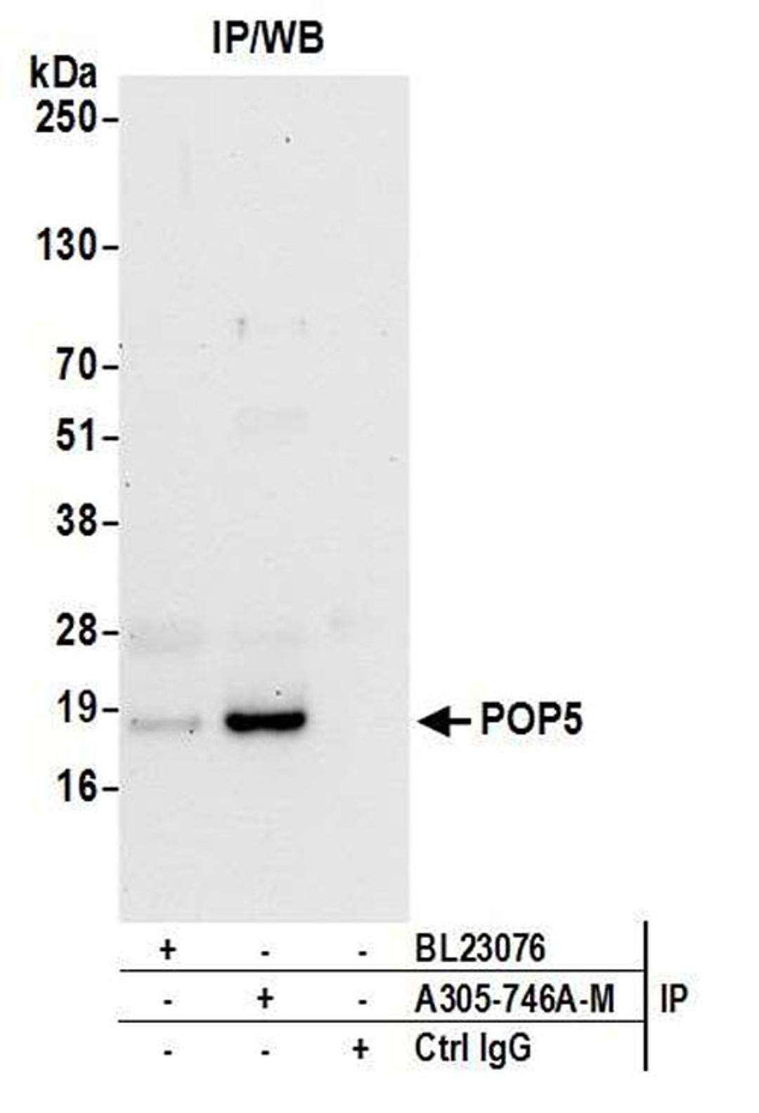 Detection of human POP5 by WB of IP.