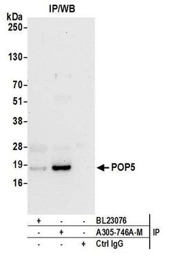 Detection of human POP5 by WB of IP.