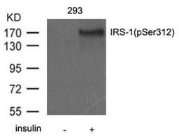 Western Blot: IRS1 [p Ser312] Antibody [NB100-81999] - Analysis of extract from 293 cells untreated or treated with insulin using IRS-1 (Phospho-Ser312) antibody