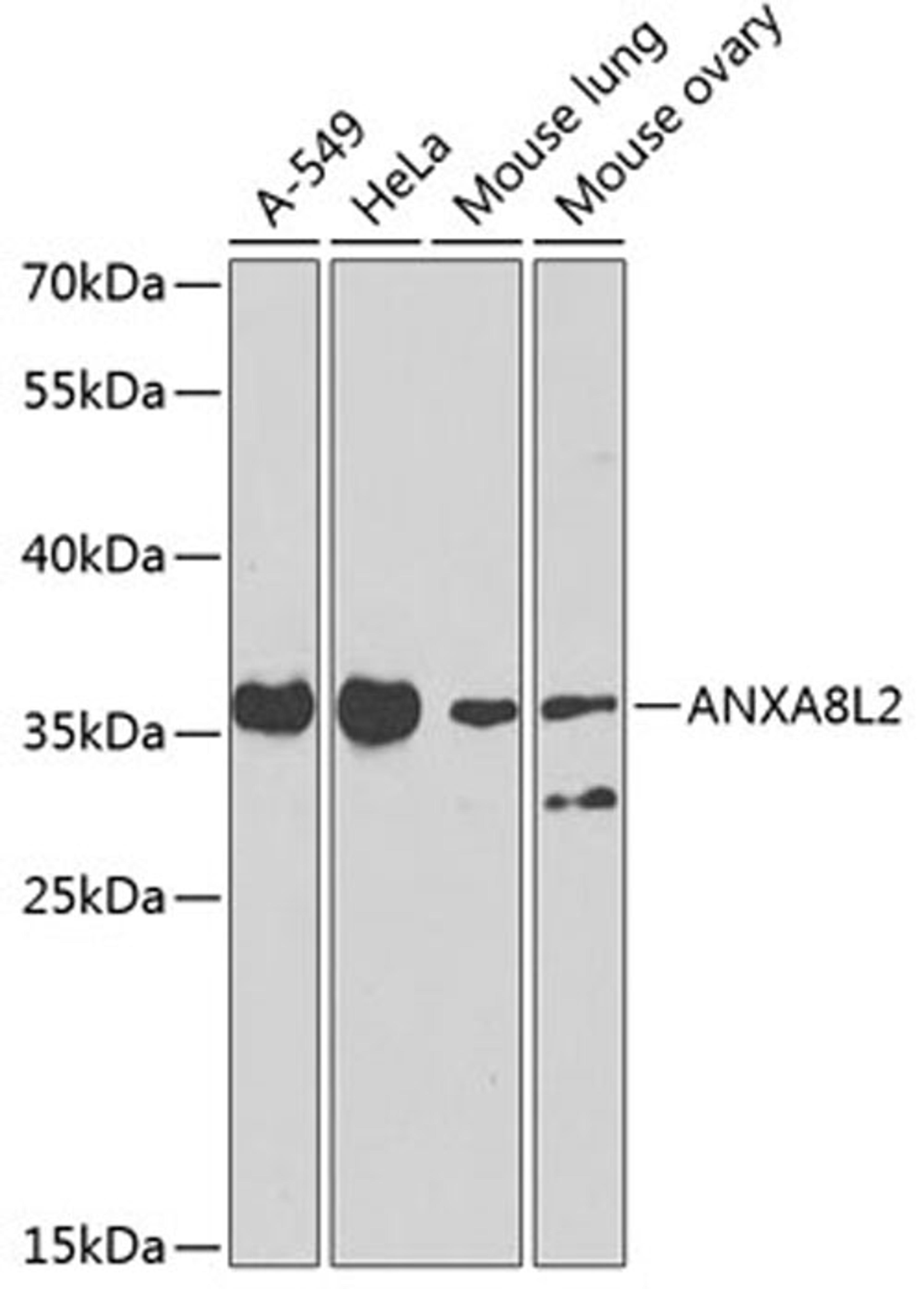 Western blot - ANXA8L2 antibody (A7641)