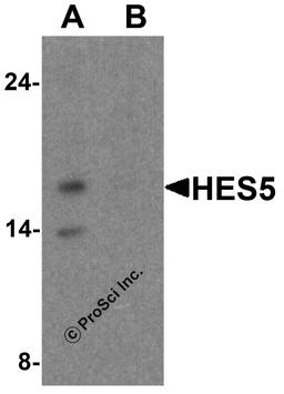 Western blot analysis of HES5 in Raji cell lysate with HES5 antibody at 1 μg/ml (A) the absence and (B) the presence of blocking peptide.