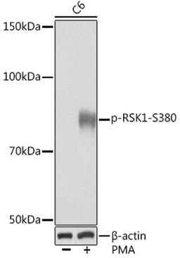 Western blot - Phospho-RSK1-S380 Rabbit mAb (AP1147)