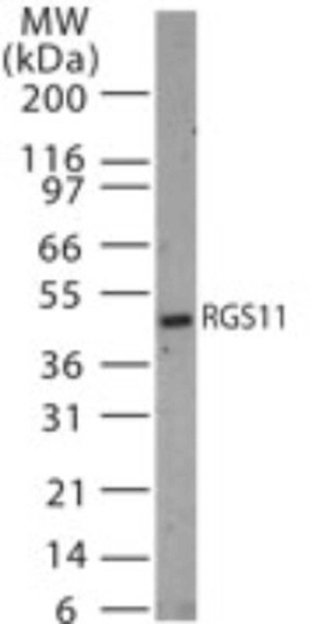 Western Blot: RGS11 Antibody [NB100-56658] - analysis of RGS11 in 30 ugs of rat brain tissue lysate using this antibody.