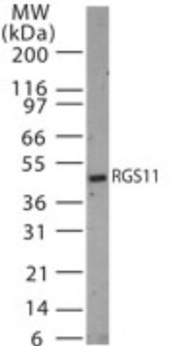 Western Blot: RGS11 Antibody [NB100-56658] - analysis of RGS11 in 30 ugs of rat brain tissue lysate using this antibody.