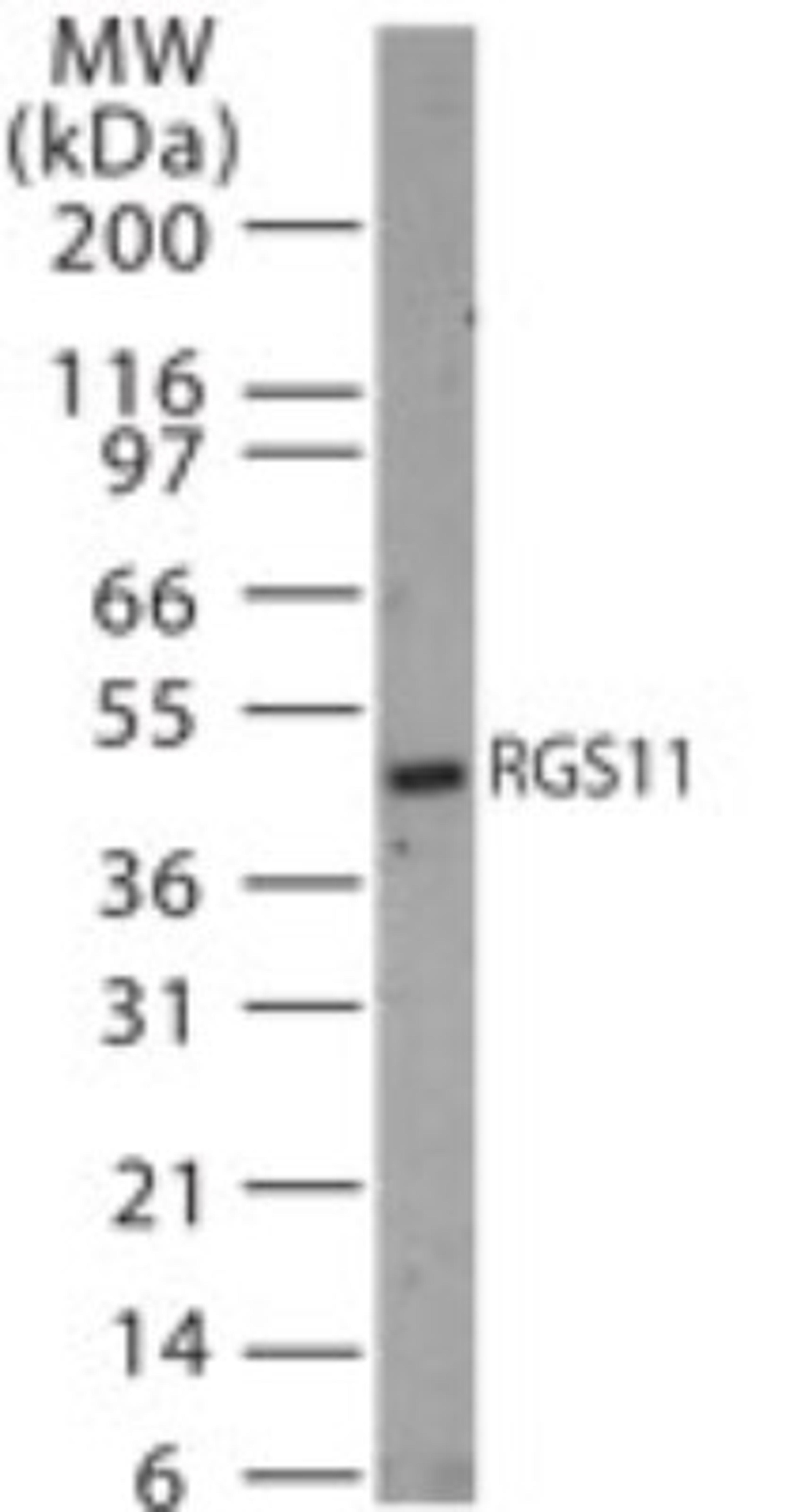 Western Blot: RGS11 Antibody [NB100-56658] - analysis of RGS11 in 30 ugs of rat brain tissue lysate using this antibody.