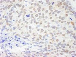 Detection of human DDX1 by immunohistochemistry.