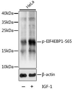 Western blot - Phospho-EIF4EBP1-S65 antibody (AP0032)