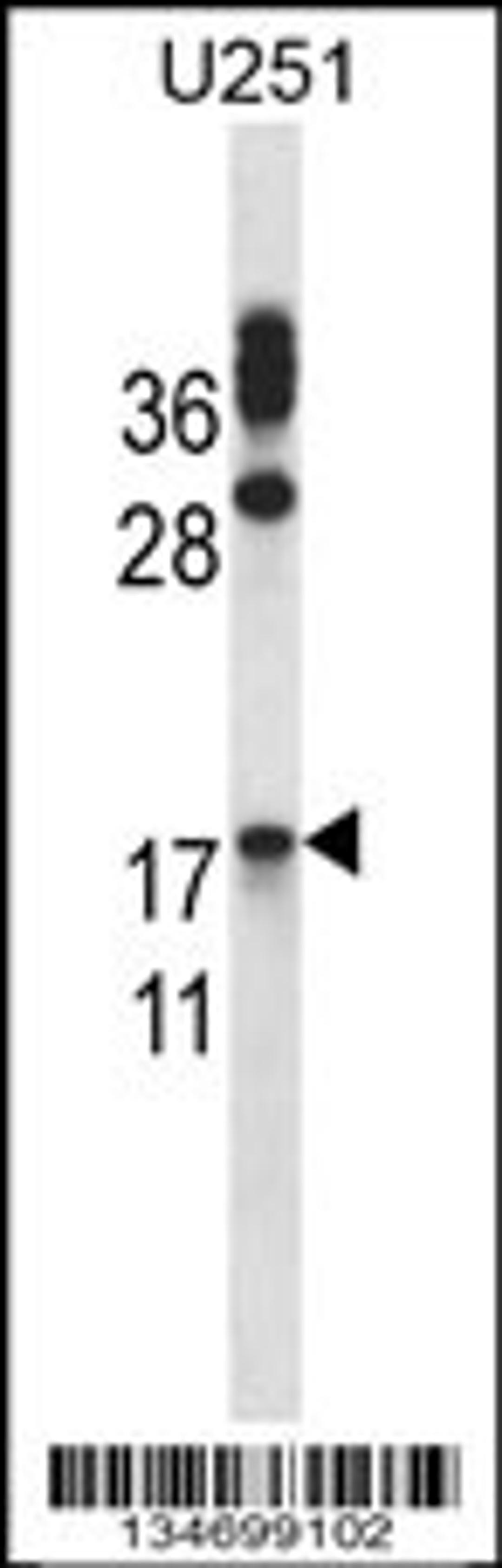 Western blot analysis in U251 cell line lysates (35ug/lane).This demonstrates the detected the CGB/HCG-Beta protein (arrow).