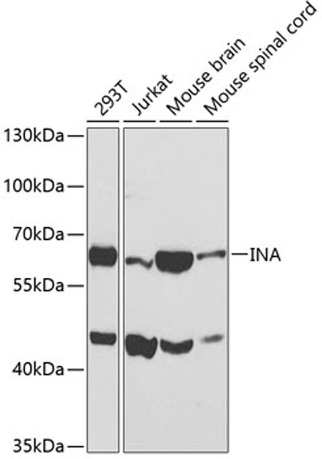 Western blot - INA antibody (A3109)