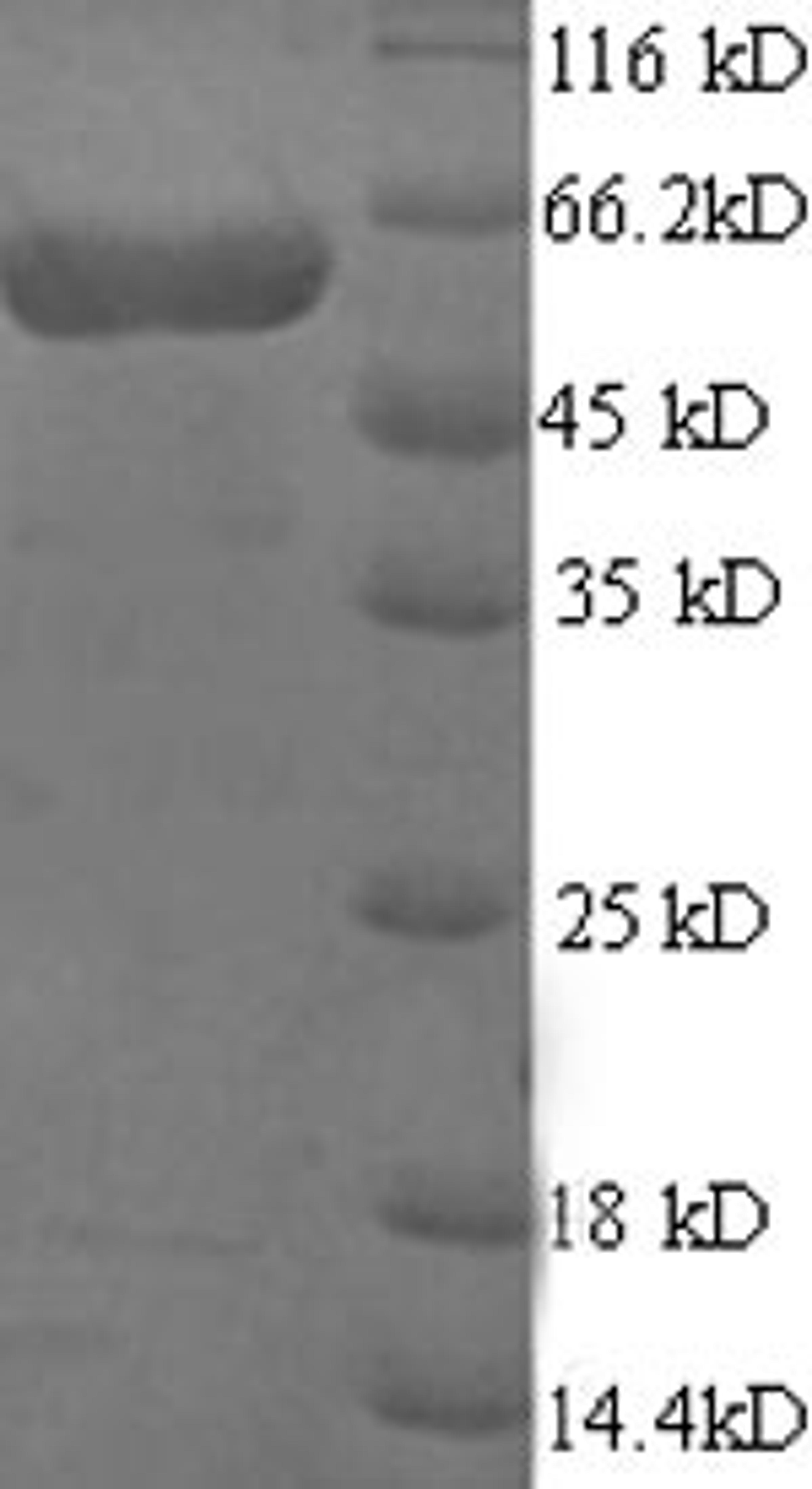 (Tris-Glycine gel) Discontinuous SDS-PAGE (reduced) with 5% enrichment gel and 15% separation gel.