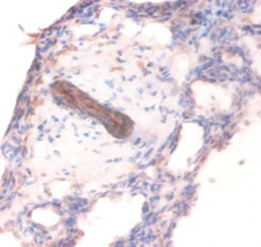 Immunohistochemistry of paraffin-embedded human lung tissue using CSB-PA11464A0Rb at dilution of 1:100