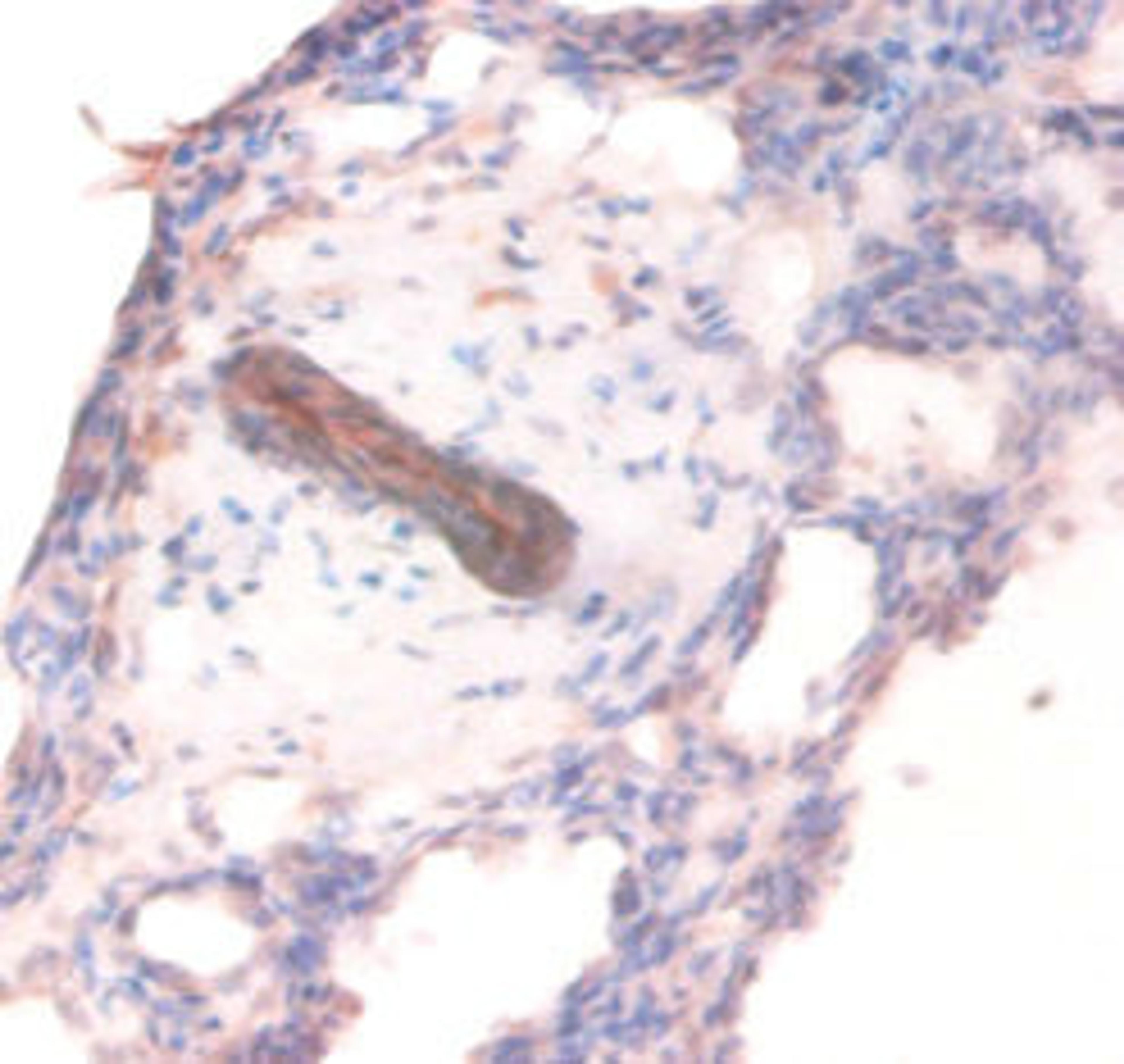 Immunohistochemistry of paraffin-embedded human lung tissue using CSB-PA11464A0Rb at dilution of 1:100