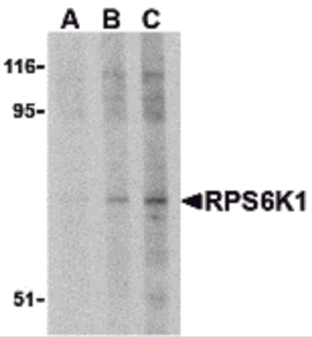 Western blot analysis of RPS6K1 in Jurkat cell lysate with RPS6K1 antibody at (A) 2.5, (B) 5 and (C) 10 μg/mL.