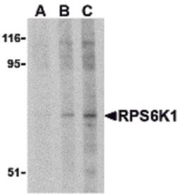 Western blot analysis of RPS6K1 in Jurkat cell lysate with RPS6K1 antibody at (A) 2.5, (B) 5 and (C) 10 μg/mL.