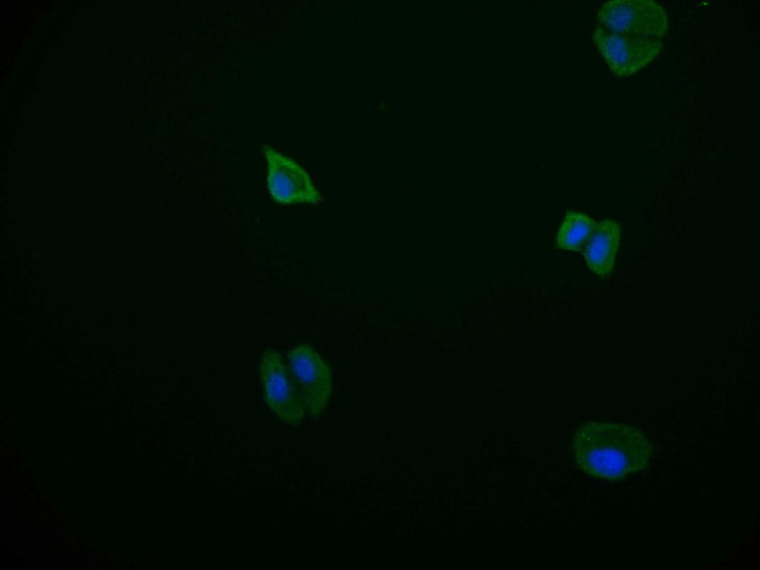 Immunofluorescence staining of HepG2 cell with CSB-RA178866A0HU at 1:50, counter-stained with DAPI. The cells were fixed in 4% formaldehyde and blocked in 10% normal Goat Serum. The cells were then incubated with the antibody overnight at 4°C. The secondary antibody was Alexa Fluor 569-congugated AffiniPure Goat Anti-Rabbit IgG(H+L).