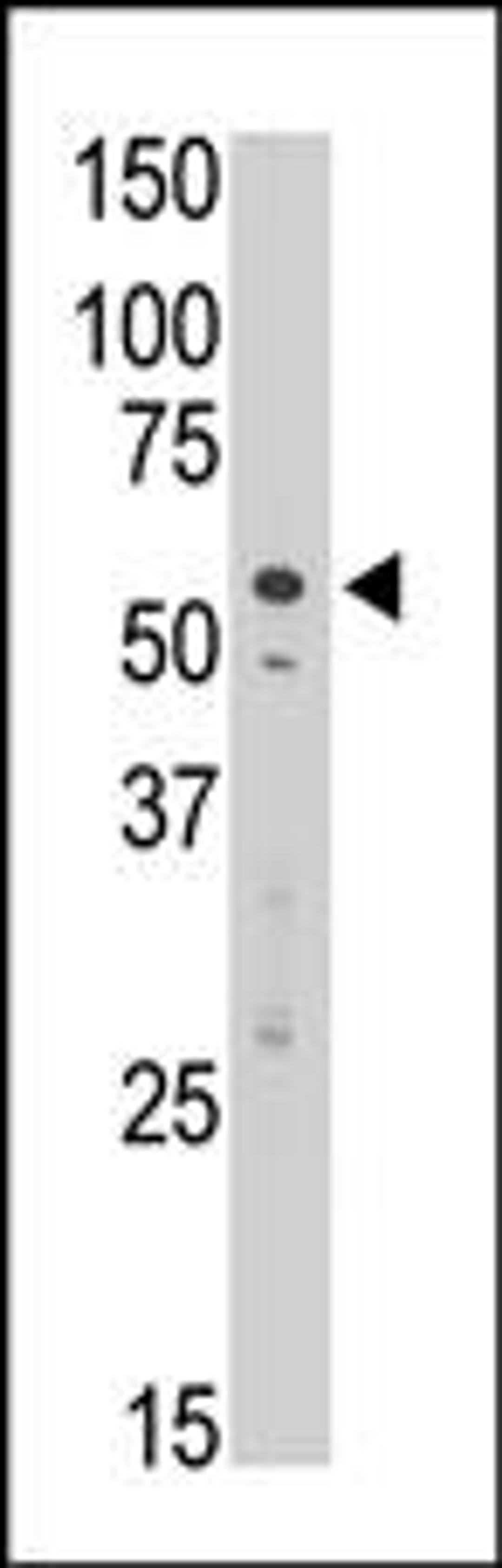 Antibody is used in Western blot to detect DSiglec in Jurkat cell lysate.