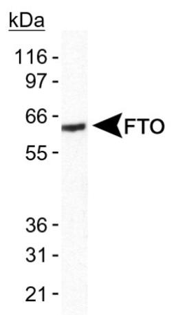 Western Blot: FTO Antibody [NB110-60935] - Detection of FTO in human brain lysate using anti-FTO NB110-60935.