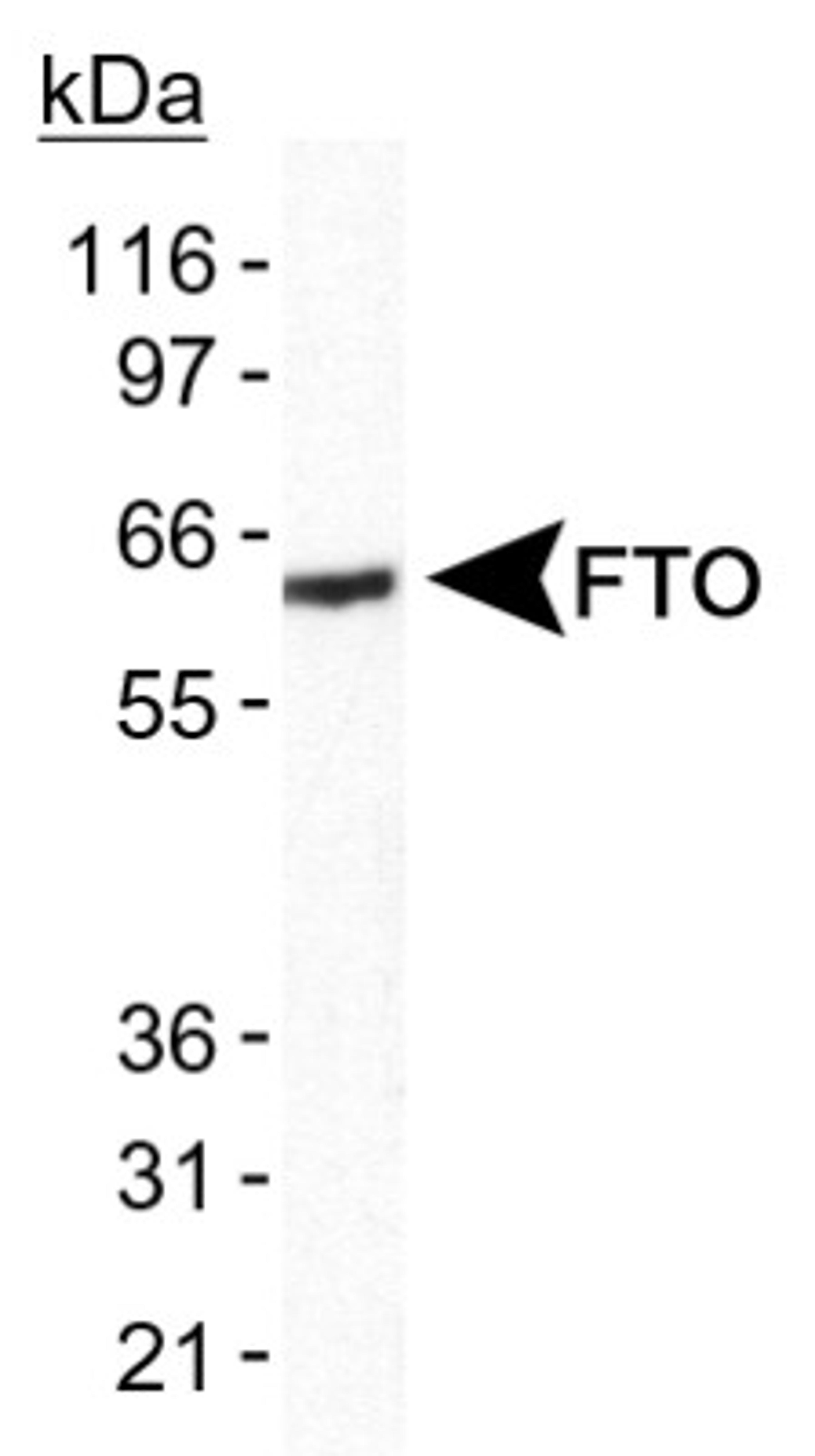 Western Blot: FTO Antibody [NB110-60935] - Detection of FTO in human brain lysate using anti-FTO NB110-60935.