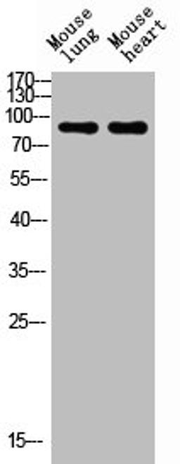 Western blot analysis of mouse-lung mouse-heart lysis using NCAM1 antibody. Antibody was diluted at 1:1000. Secondary antibody was diluted at 1:20000