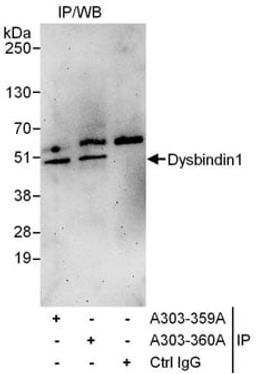 Detection of human Dysbindin1 by western blot of immunoprecipitates.