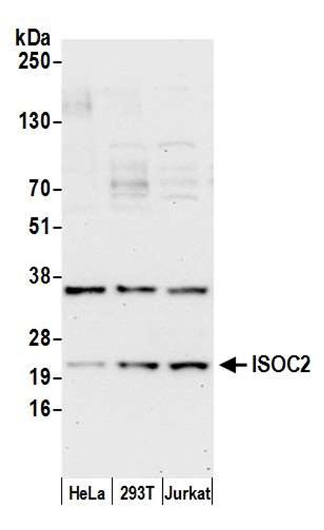 Detection of human ISOC2 by WB.