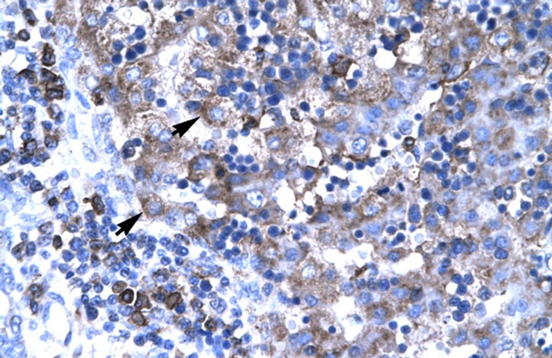 Antibody used in IHC on Human Liver.