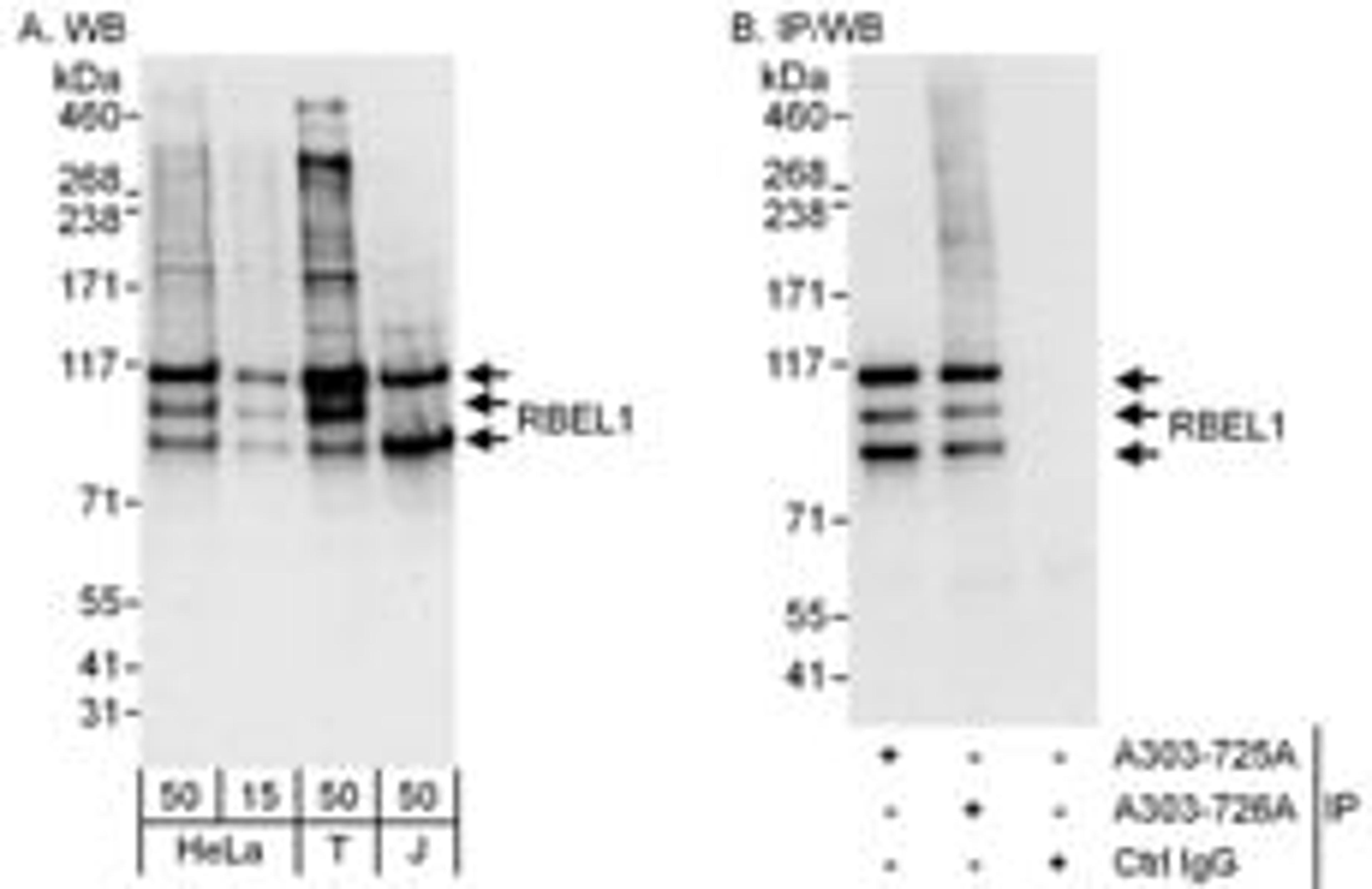 Detection of human RBEL1 by western blot and immunoprecipitation.