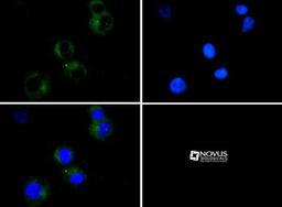 Immunocytochemistry/Immunofluorescence: CD4 Antibody [NBP1-19371] - CD4 antibody was tested in Jurkat cells with Dylight 488 (green). Nuclei were counterstained with DAPI (blue).