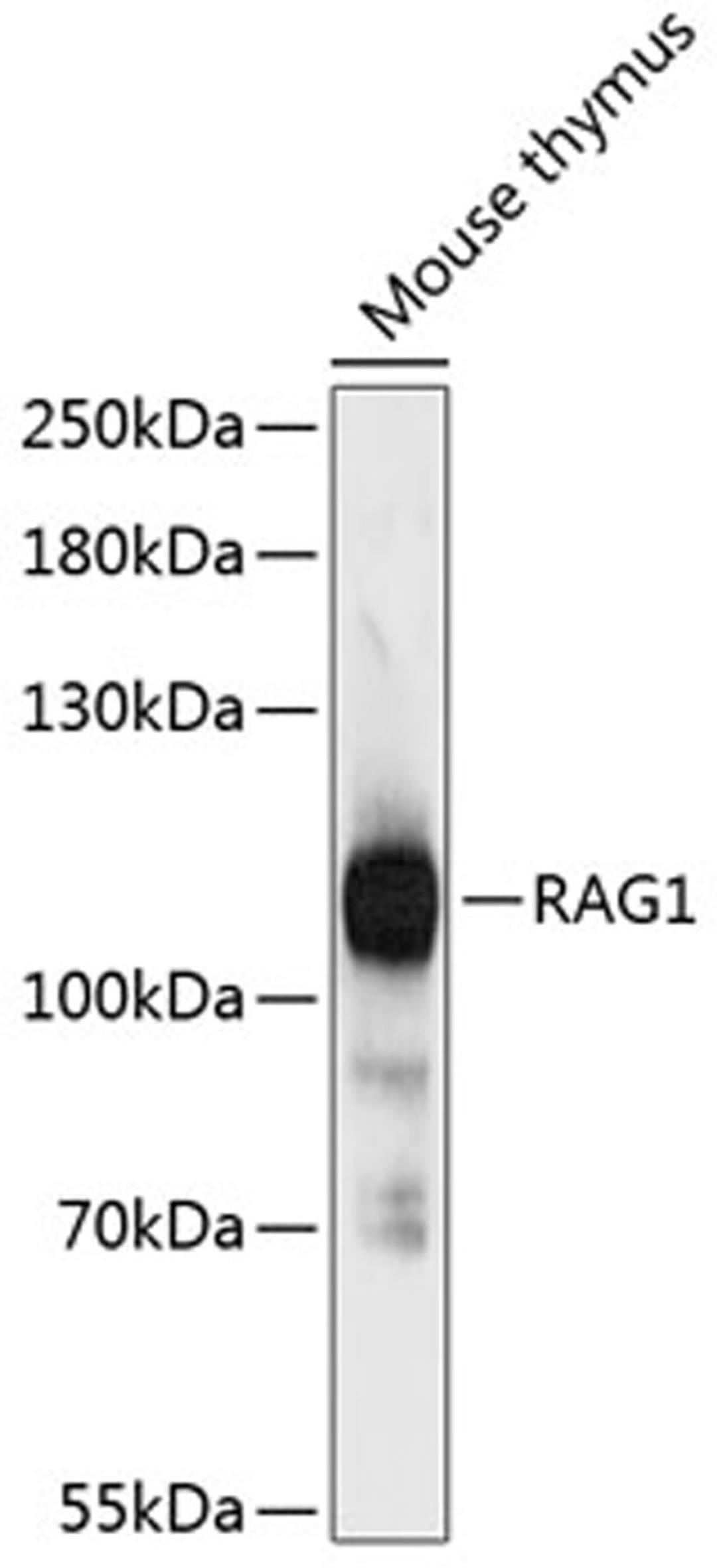 Western blot - RAG1 antibody (A12646)