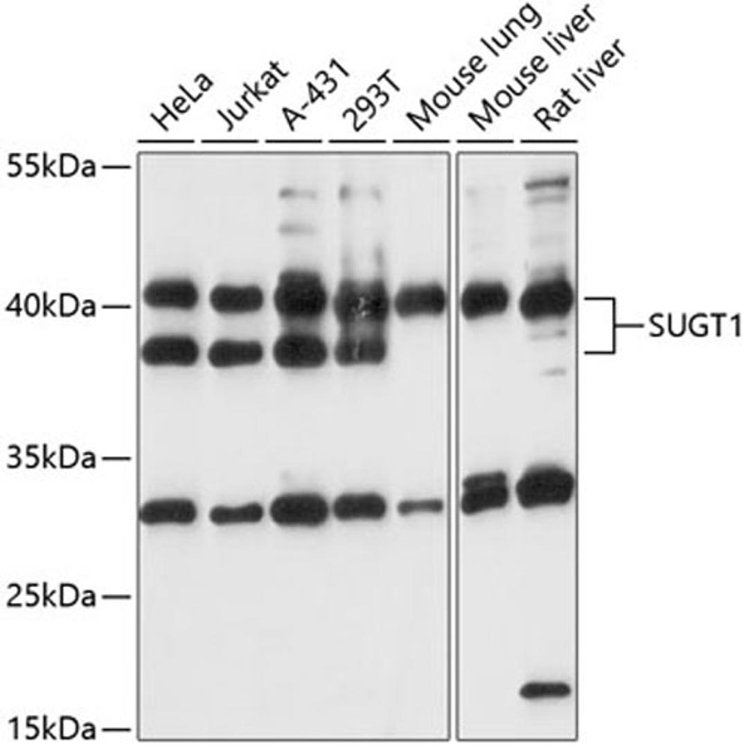 Western blot - SUGT1 antibody (A13908)