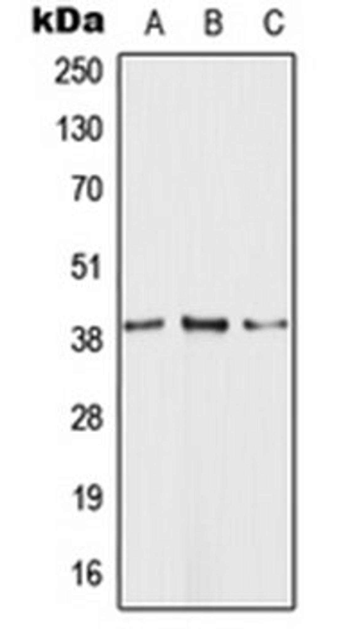 Western blot analysis of HEK293T (Lane 1), Raw264.7 (Lane 2), PC12 (Lane 3) whole cell lysates using HCAR1 antibody