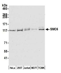 Detection of human and mouse SMC6 by WB.