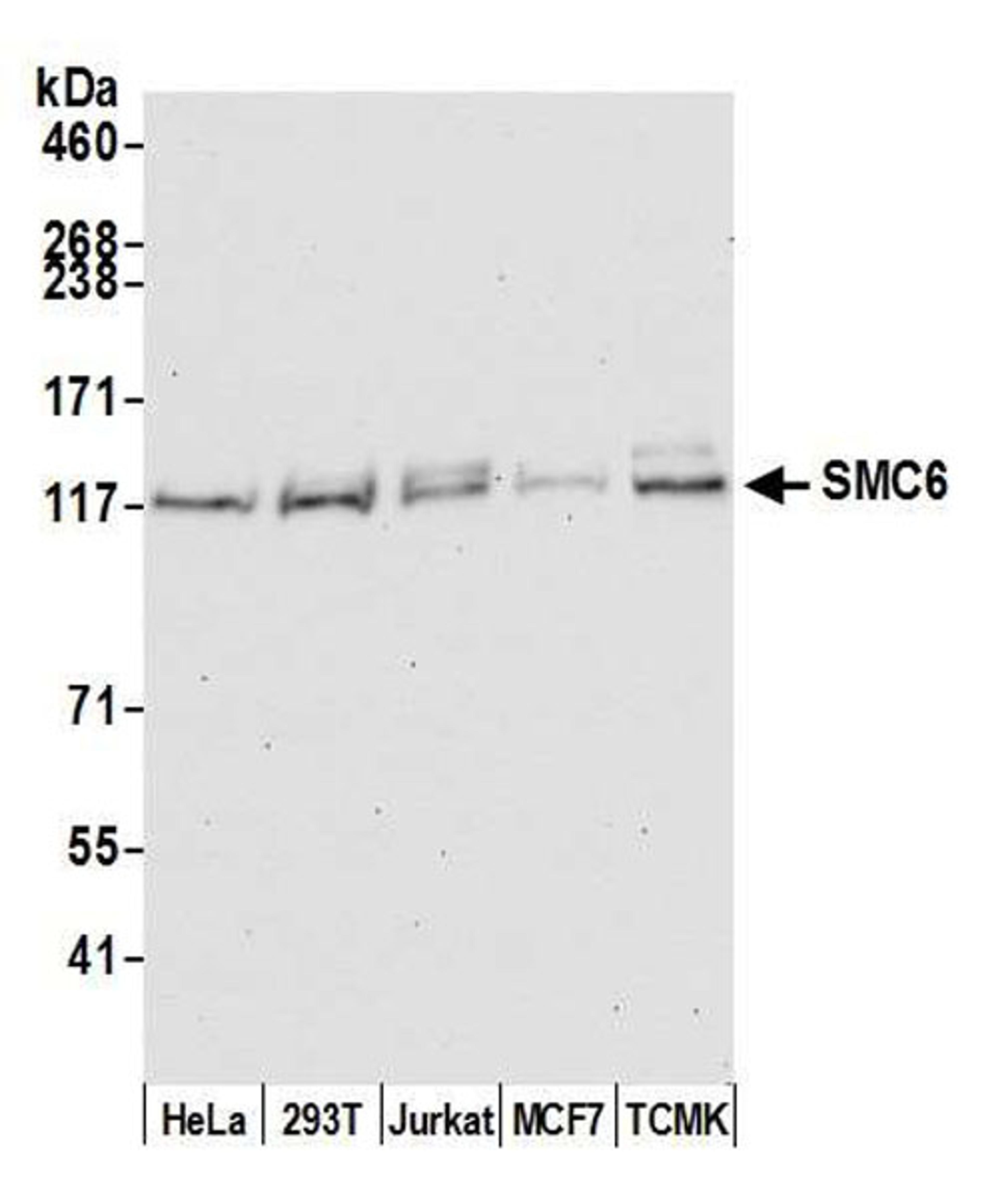 Detection of human and mouse SMC6 by WB.