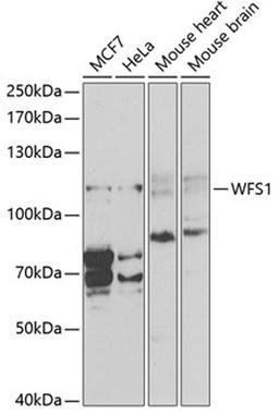 Western blot - WFS1 antibody (A1705)