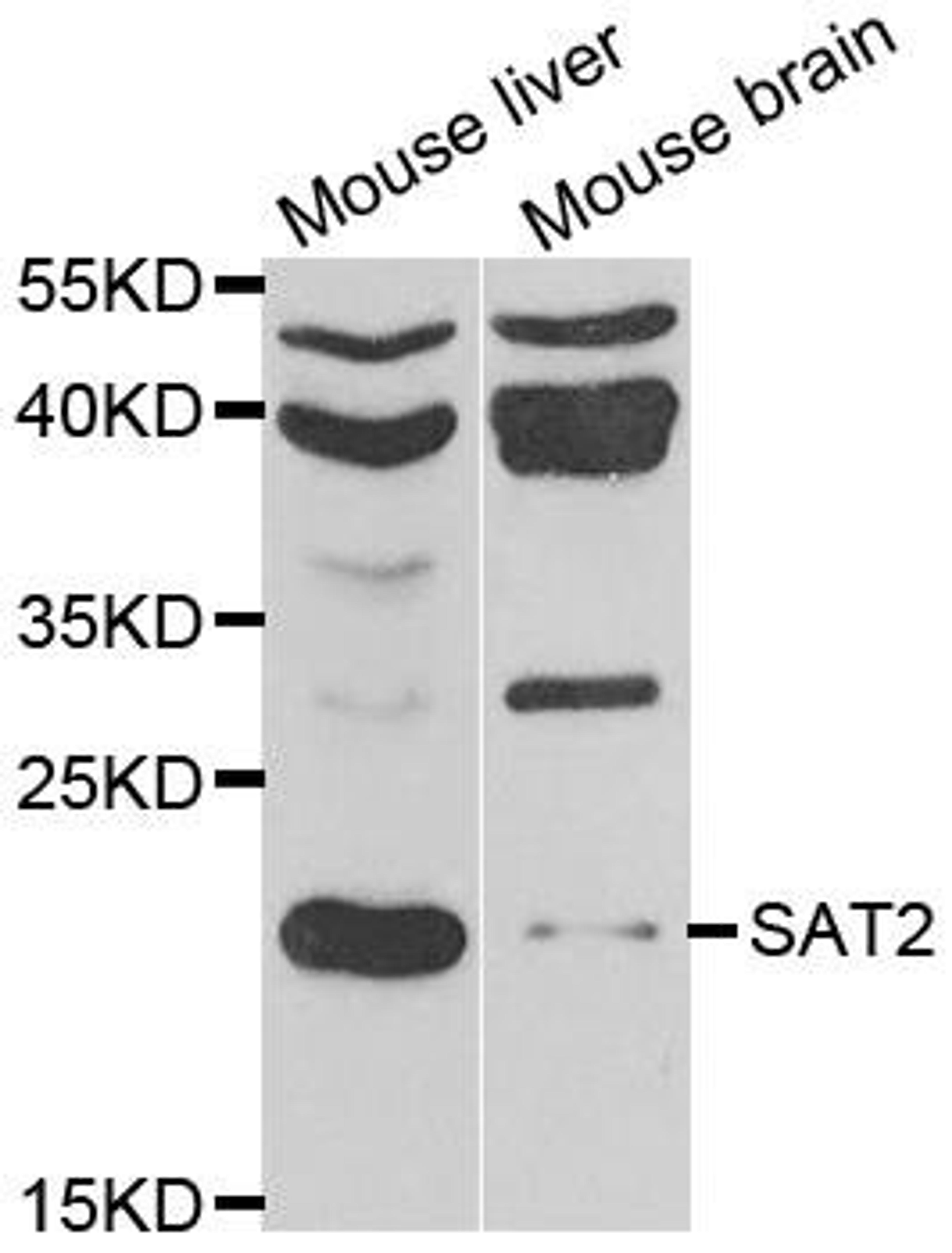 Western blot analysis of extracts of various cell lines using SAT2 antibody