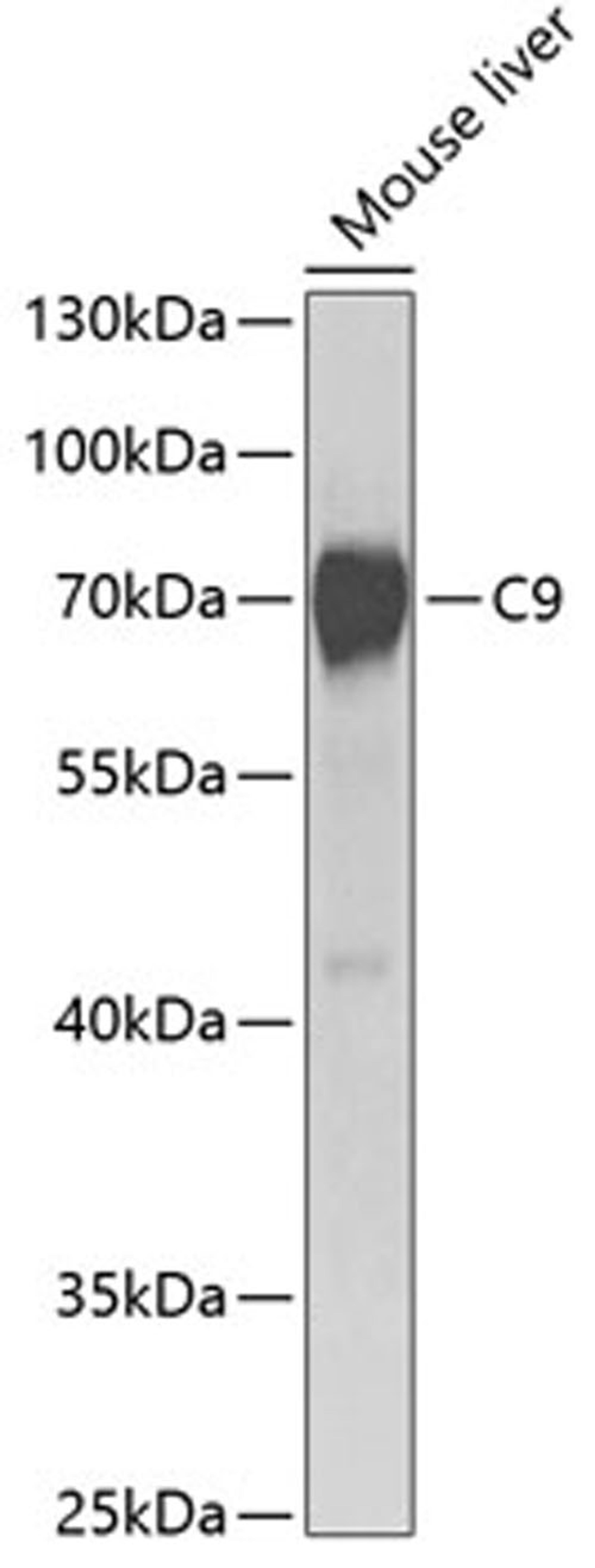 Western blot - C9 antibody (A5622)