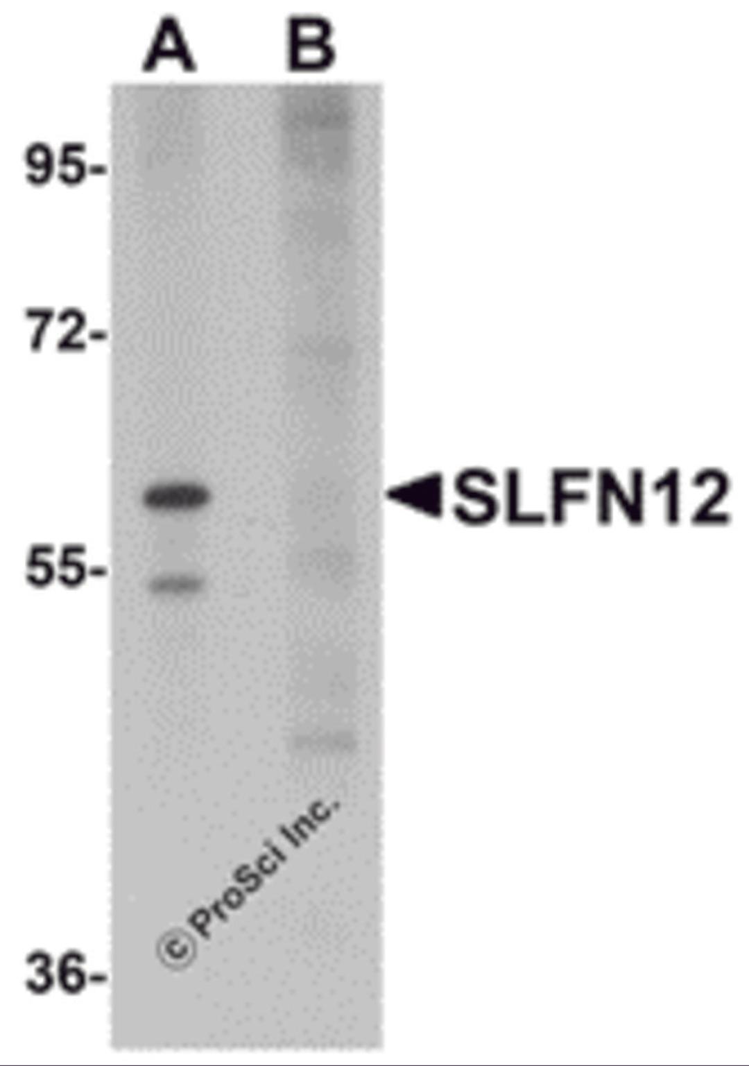 Western blot analysis of SLFN12 in SK-N-SH cell lysate with SLFN12 antibody at 1 &#956;g/mL in (A) the absence and (B) the presence of blocking peptide.