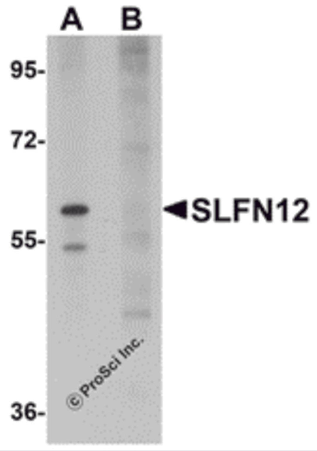 Western blot analysis of SLFN12 in SK-N-SH cell lysate with SLFN12 antibody at 1 μg/mL in (A) the absence and (B) the presence of blocking peptide.
