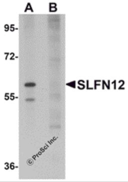 Western blot analysis of SLFN12 in SK-N-SH cell lysate with SLFN12 antibody at 1 μg/mL in (A) the absence and (B) the presence of blocking peptide.