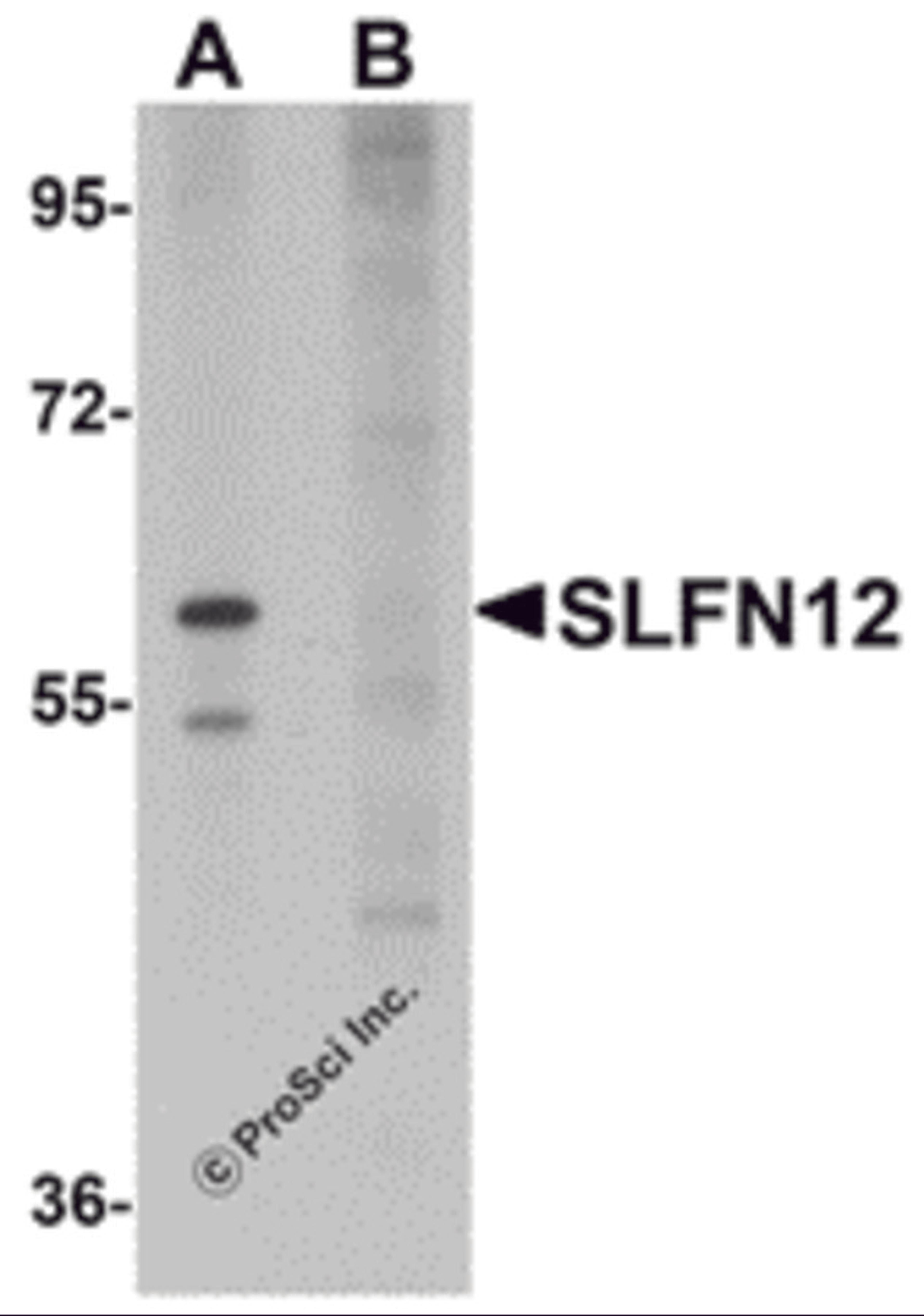 Western blot analysis of SLFN12 in SK-N-SH cell lysate with SLFN12 antibody at 1 μg/mL in (A) the absence and (B) the presence of blocking peptide.