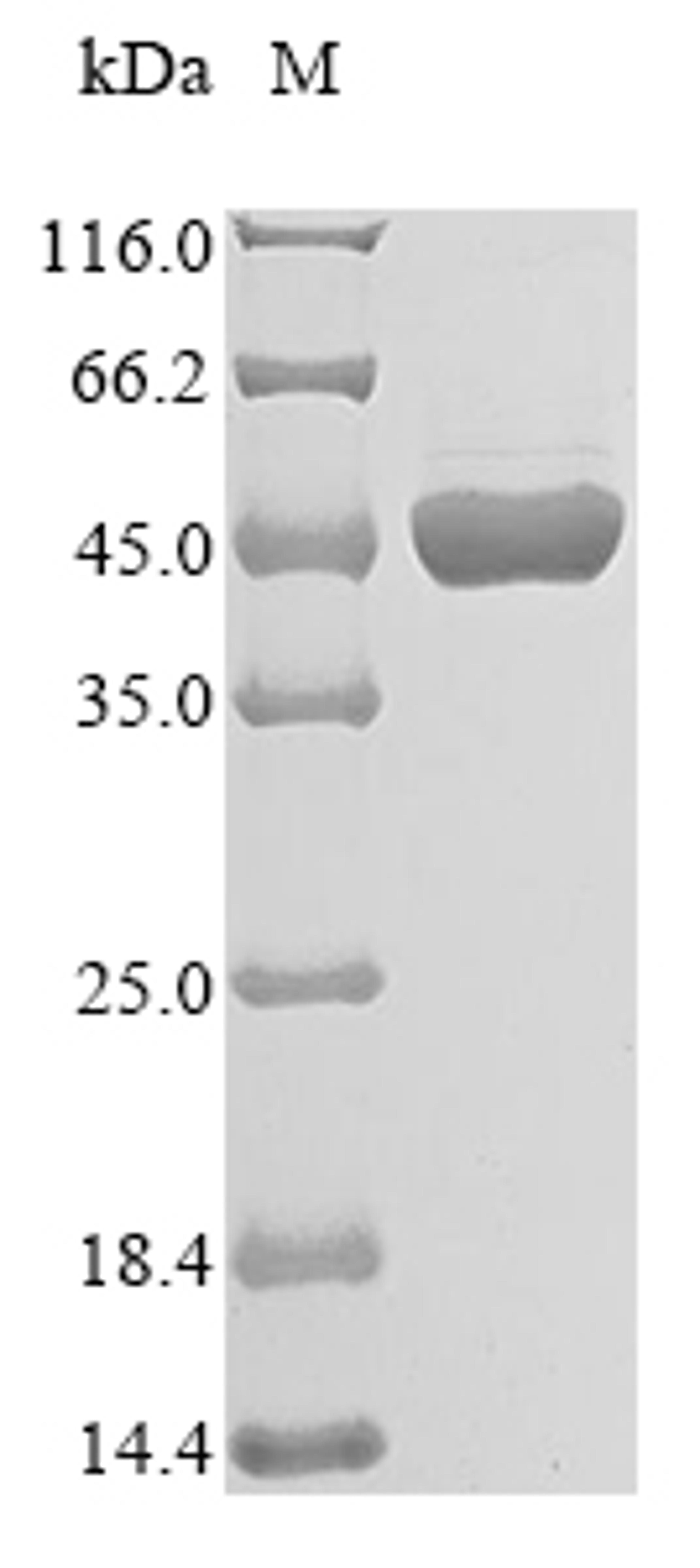 (Tris-Glycine gel) Discontinuous SDS-PAGE (reduced) with 5% enrichment gel and 15% separation gel.