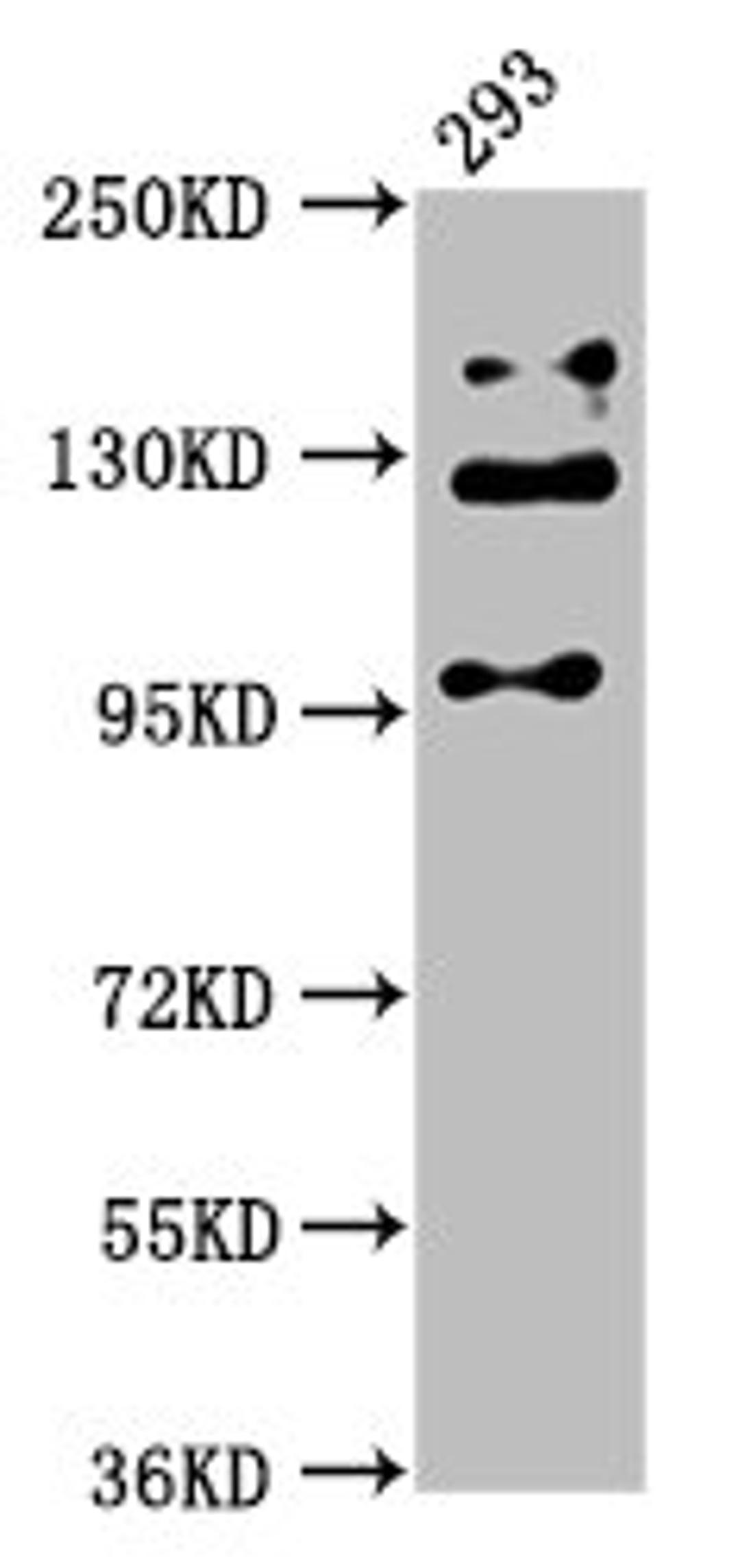 Western Blot. Positive WB detected in: 293 whole cell lysate. All lanes: RAB3GAP2 antibody at 5ug/ml. Secondary. Goat polyclonal to rabbit IgG at 1/50000 dilution. Predicted band size: 156, 24 kDa. Observed band size: 110, 130, 150 kDa. 