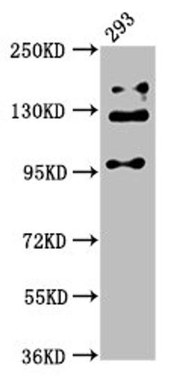 Western Blot. Positive WB detected in: 293 whole cell lysate. All lanes: RAB3GAP2 antibody at 5ug/ml. Secondary. Goat polyclonal to rabbit IgG at 1/50000 dilution. Predicted band size: 156, 24 kDa. Observed band size: 110, 130, 150 kDa. 