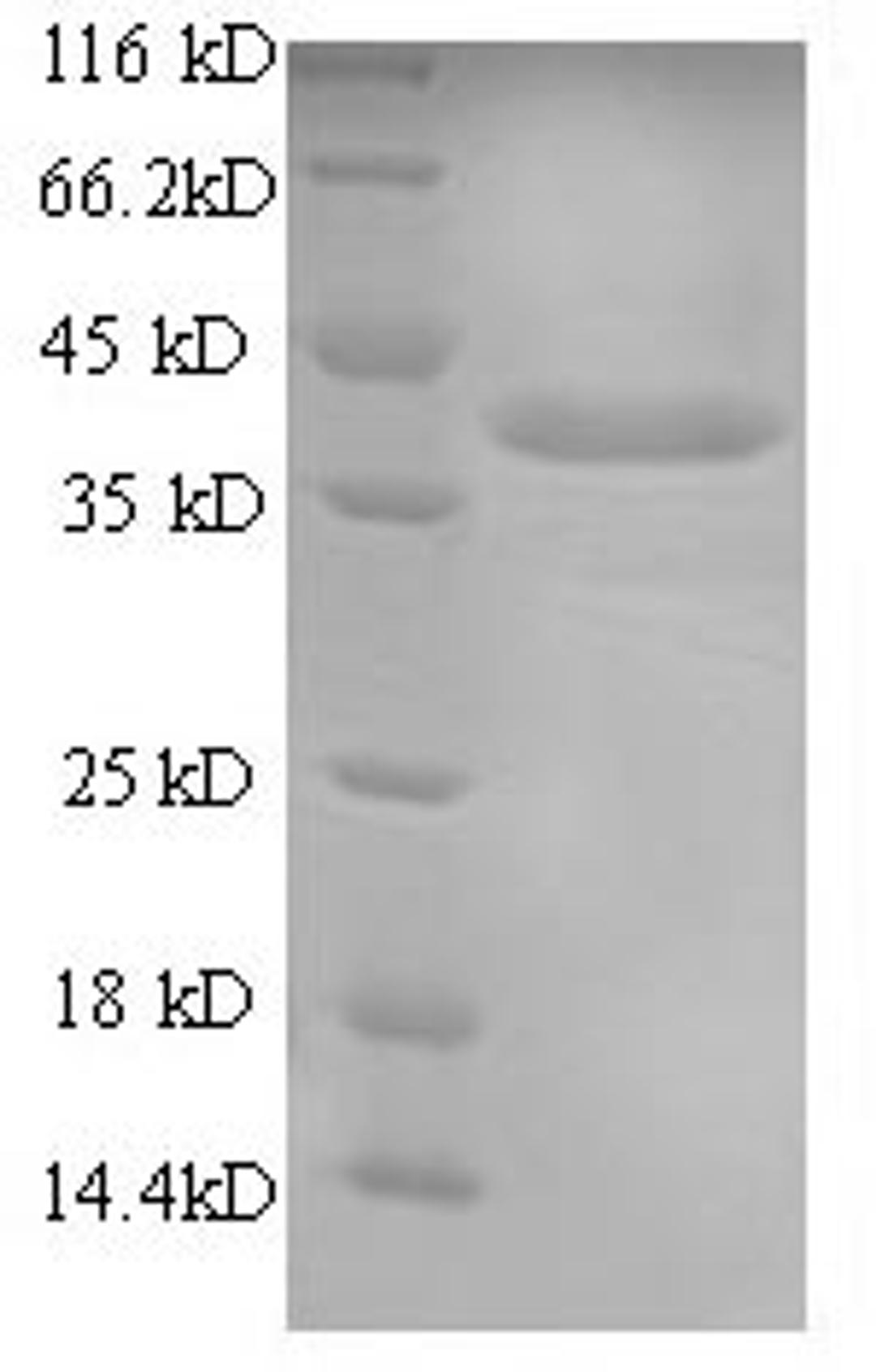 (Tris-Glycine gel) Discontinuous SDS-PAGE (reduced) with 5% enrichment gel and 15% separation gel.